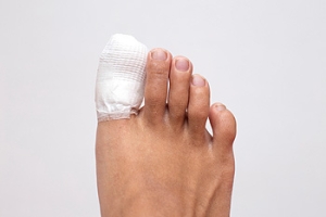 What to Do with a Broken Toe