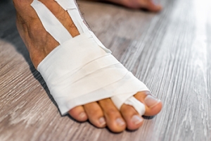 Managing Turf Toe