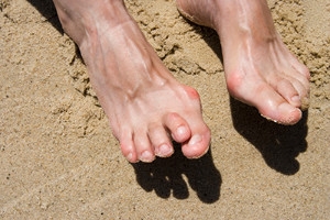 Understanding Hammertoe and When to Seek Care