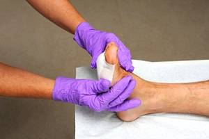 Diabetes and Wound Healing