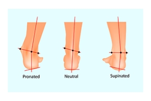 How Pronation Affects Your Feet
