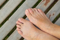 Differences Between Hammertoe and Claw Toe