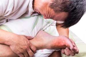 Foods Related to Gout