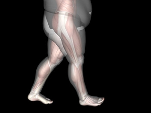The Impact of Obesity on Children&#039;s Feet