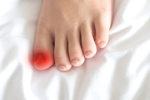 How Did I Get an Ingrown Toenail?