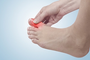 Managing Gout for Better Foot Health